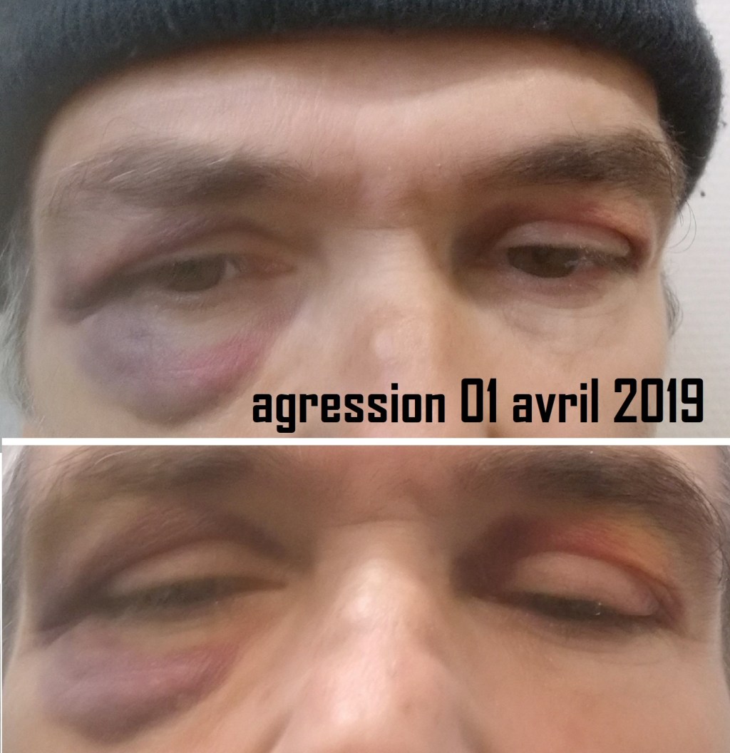 22/02/2022 La victime est condamnée pour s&rsquo;être défendue lors d&rsquo;une 5ème agression le 01 avril&nbsp;2019